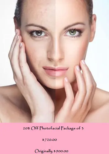 photofacial22